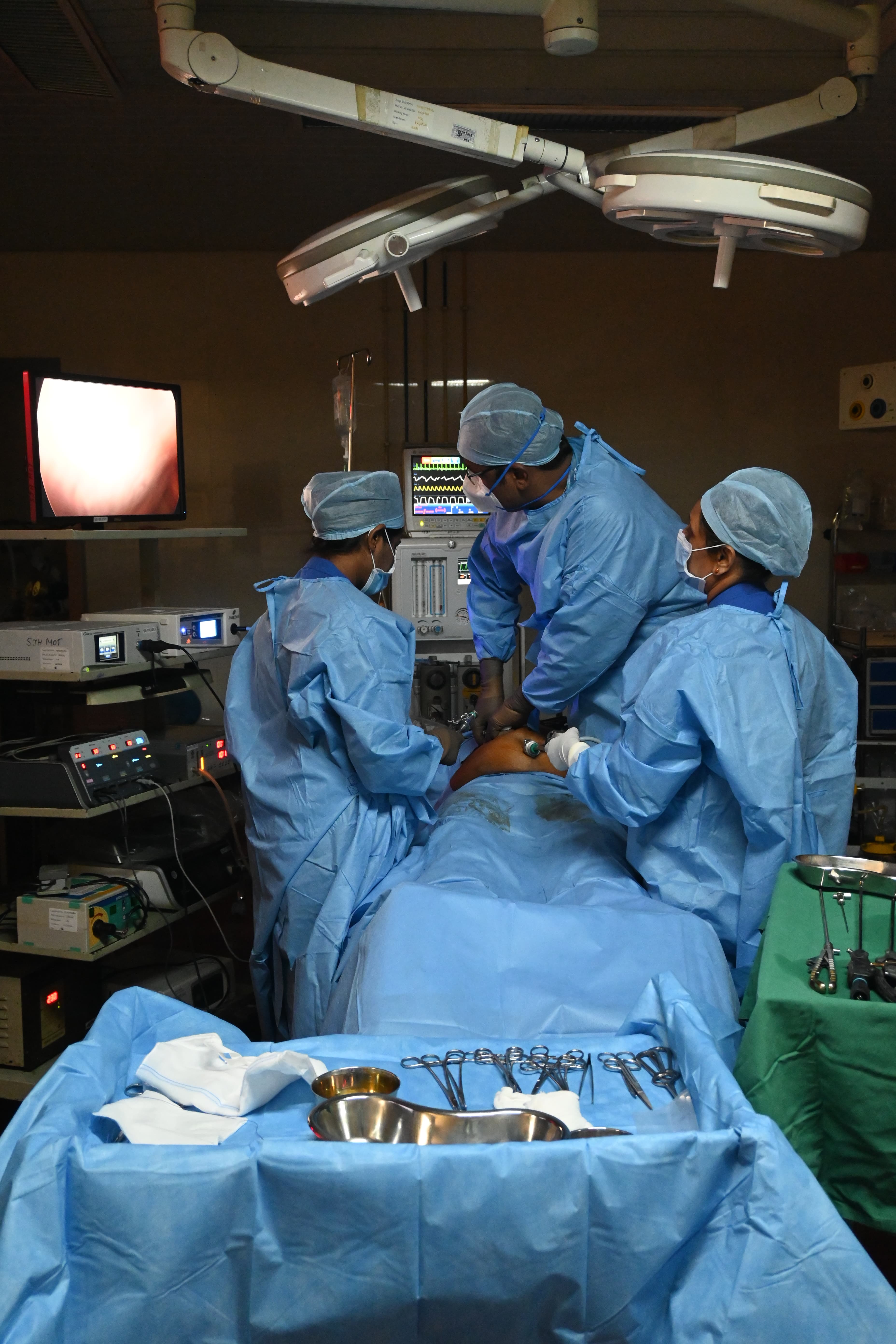 Laparoscopy